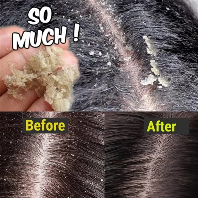 Fast Anti Dandruff Hair Treatm - Castor Oil Soap recension och pris